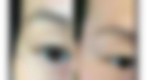 二、富阳韩加医疗美容门诊部是正规医院吗？