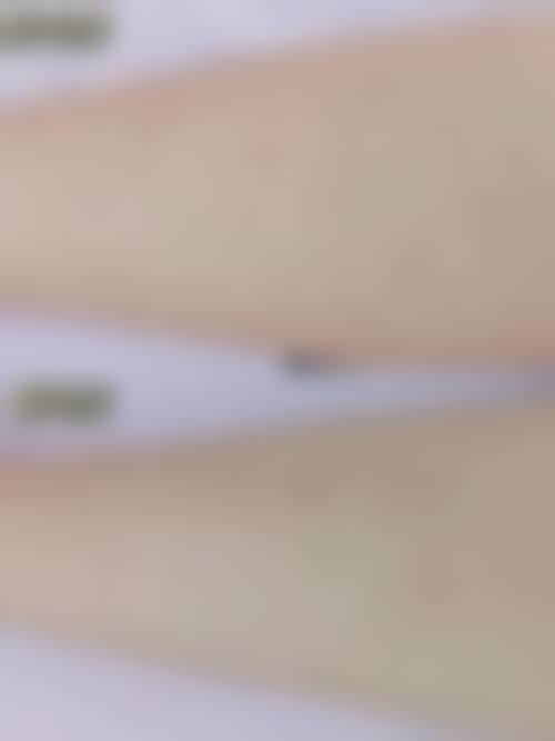 二、南通俪人连天美植发整形科是正规医院吗？