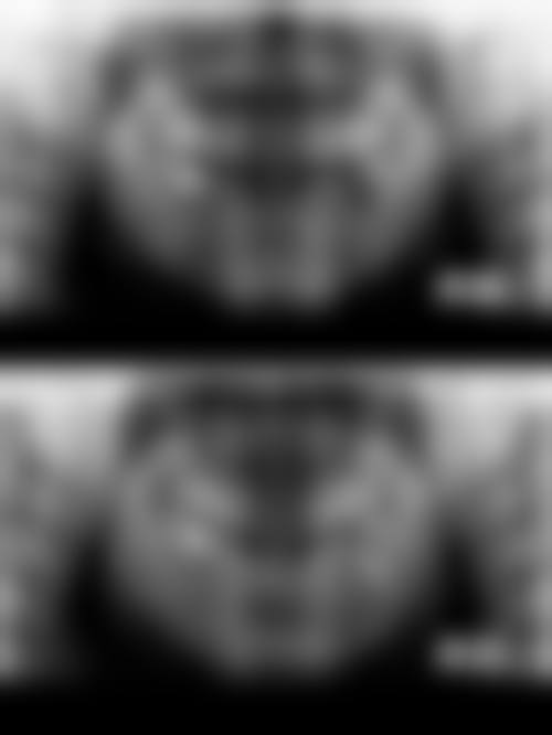 牙立德口腔：中老年看牙的放心之选