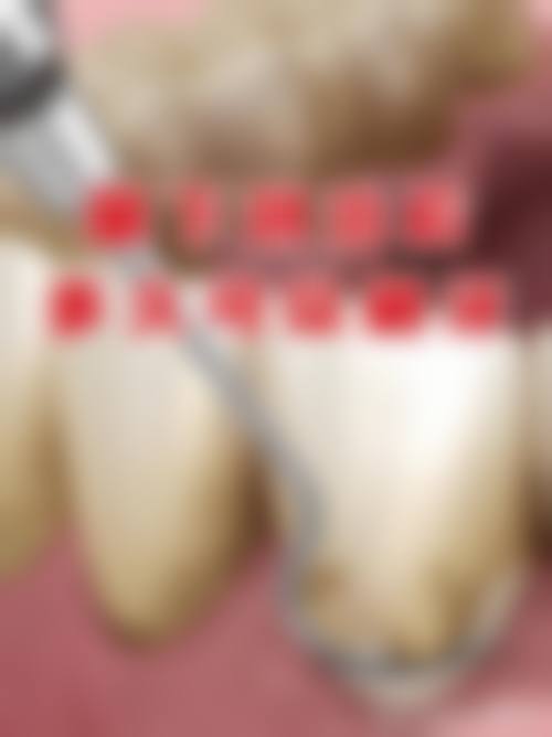 整形项目分类价目表