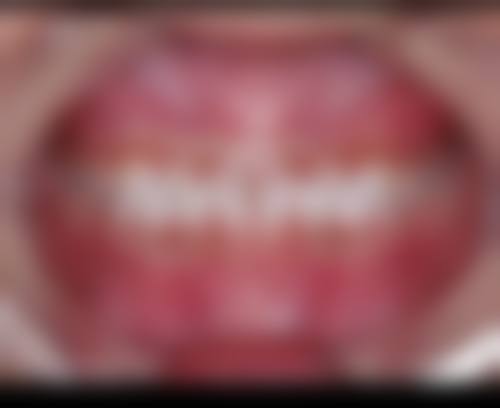 多样选择：常见的矫正方法大盘点