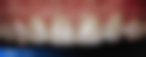 深圳根管治疗医院推荐