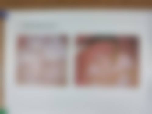 看牙价格表，种植牙3980元起、全瓷牙1500元起、根管治疗600元起