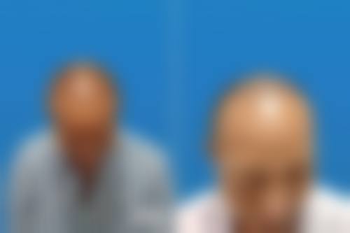 二、无锡同济医疗美容门诊部是正规医院吗？