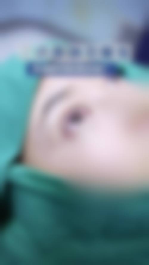 六、东港挚颜整形医院口碑怎么样