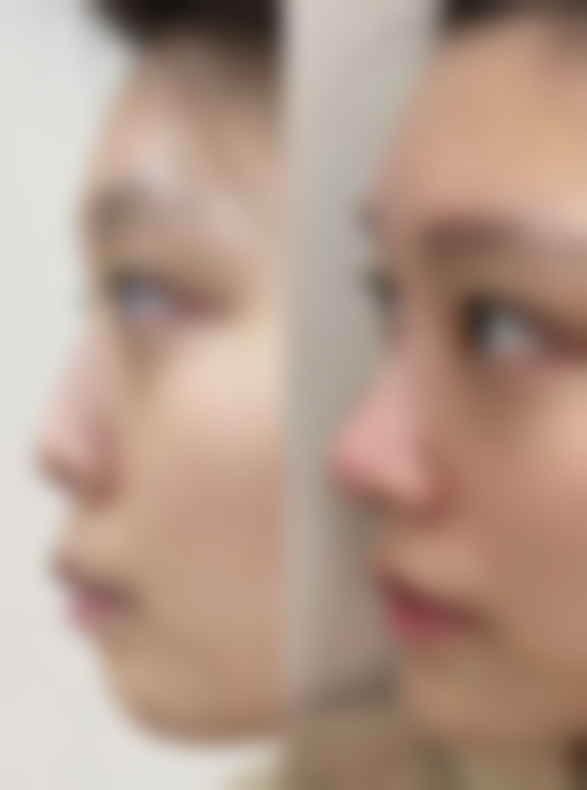 二、南京江宁芙悦医疗美容诊所是正规医院吗？