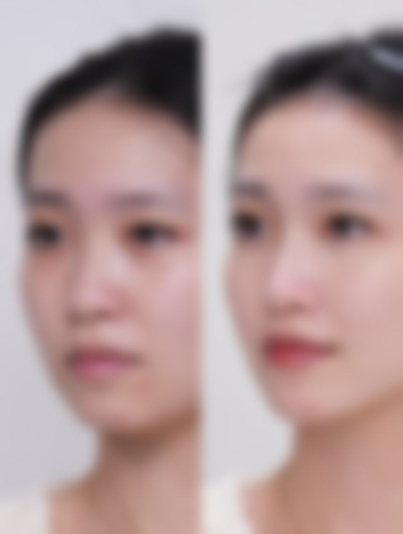 六、南通俪人连天美植发整形科口碑怎么样？