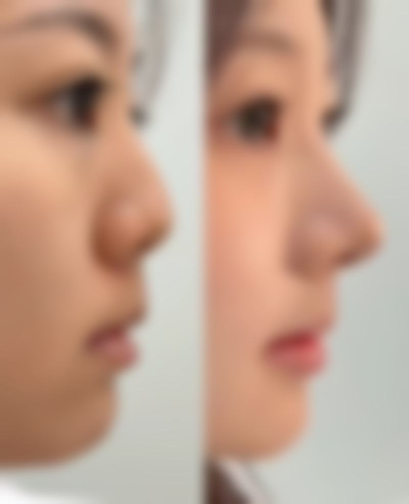 七、惠州百佳伊丽莎白妇产医院整形科口碑怎么样？