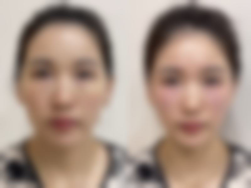 二、东港挚颜整形医院是正规医院吗