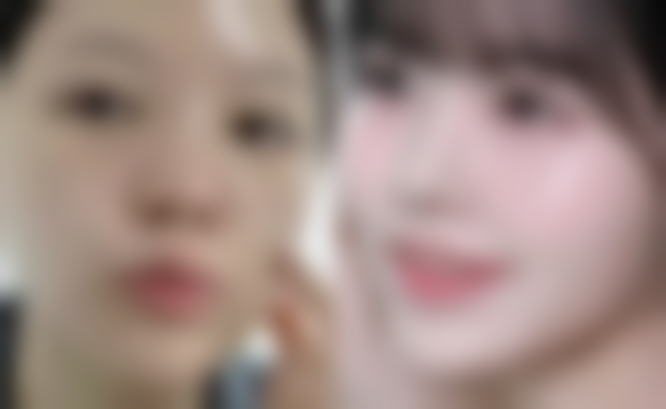 七、南通俪人连天美植发整形科预约挂号方式及流程