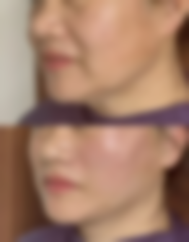 白馨月院长预约挂号