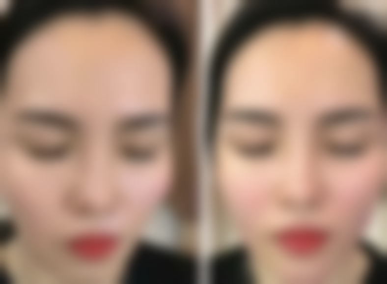 六、北京艾玛医疗美容收费价格表