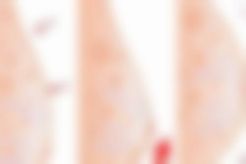 六、揭阳华美整形美容医院收费价格表