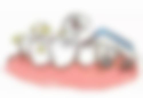 补牙后疼痛超预期该如何正确应对