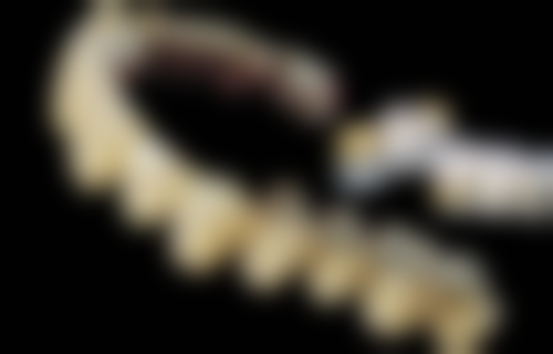 宁波种植牙医院排名靠前的种牙技术