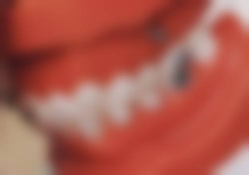 根管内的软组织——牙齿健康的“守护者”