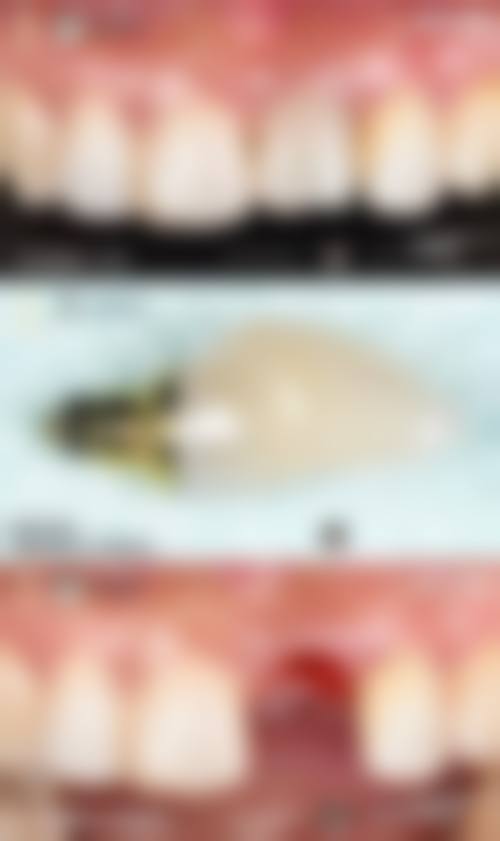 百丹特（Biodenta）：生物活性与精密制造的融合