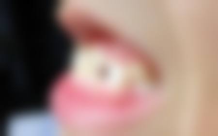 纠正不良习惯：为矫正奠定基础