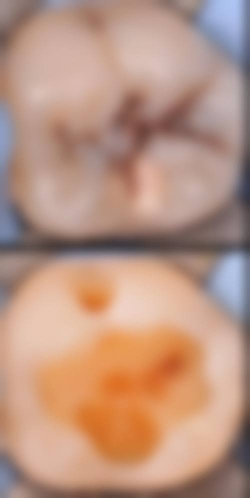 佛山口腔医院预约方式