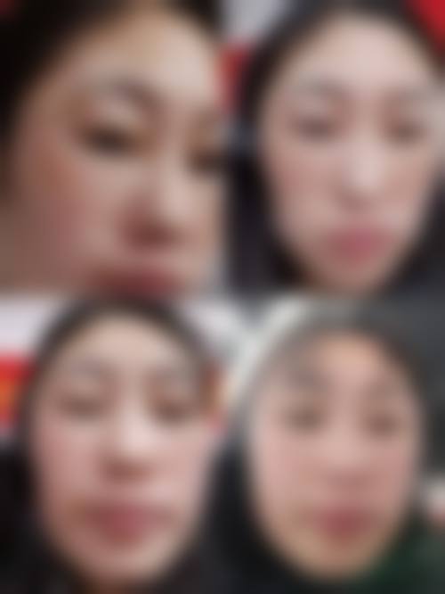 四、西安欣薇医疗美容诊所特色项目及技术优势