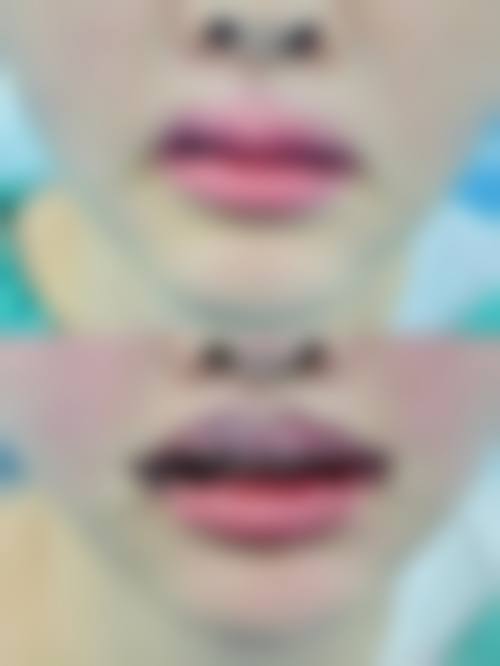 三、滁州天长恒美整形医疗美容门诊部地址电话营业时间