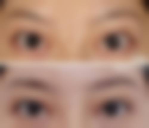 六、巴中依韩（原双均）医疗美容诊所收费价格表