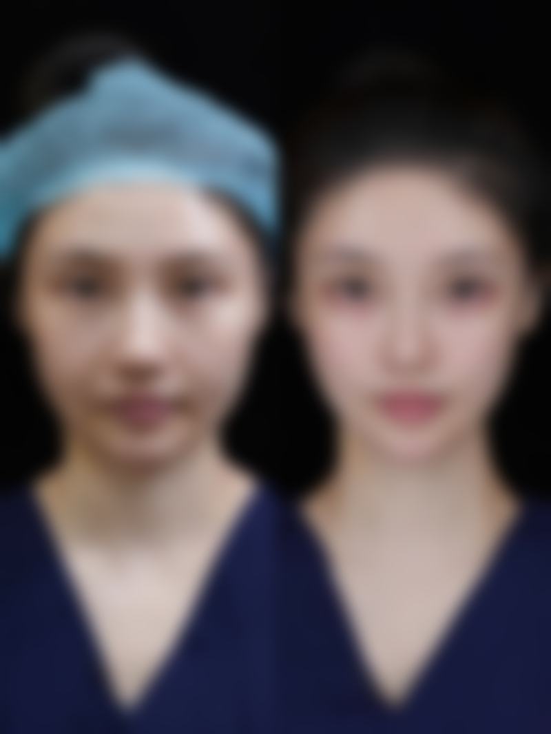 五、杭州康森整形医院收费价格表