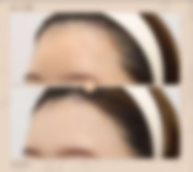 二、滁州天长恒美整形医疗美容门诊部是正规医院吗？