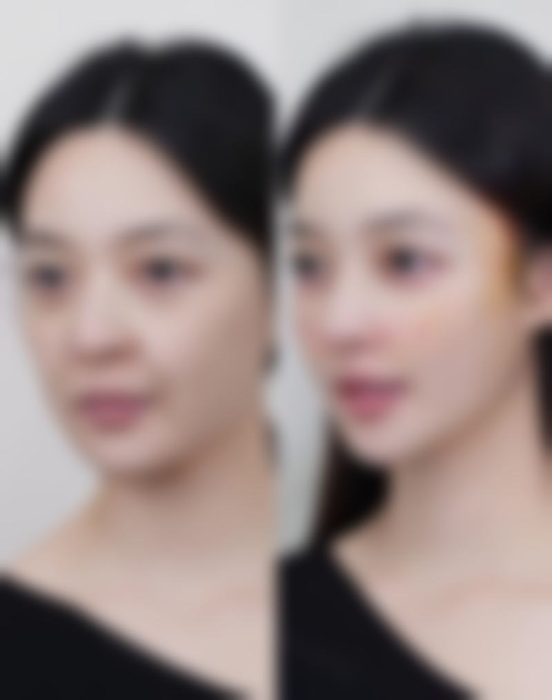 五、西安欣薇医疗美容诊所收费价格表