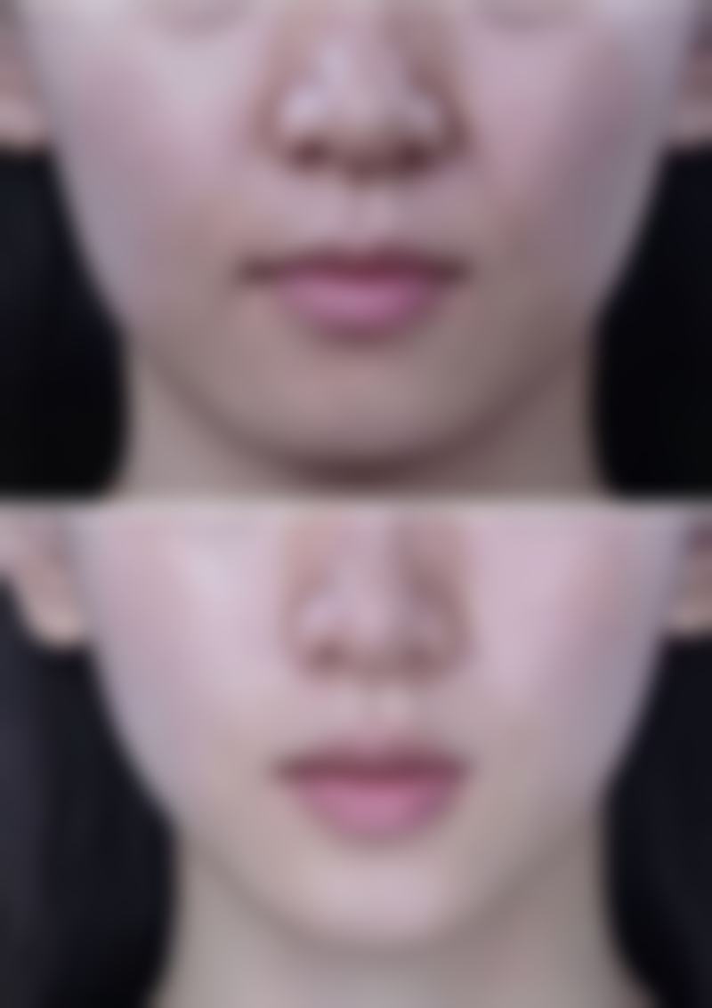 四、厦门三维焕新整形医院特色项目及技术优势