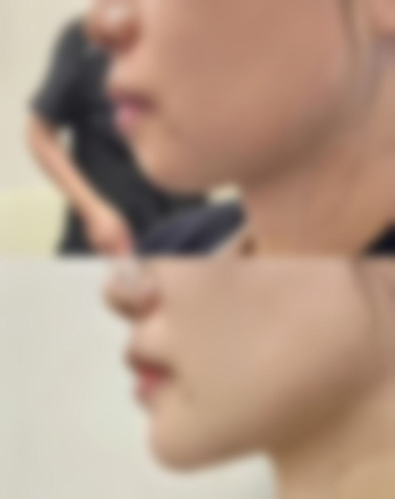 二、广州天姿医学整形美容门诊部是正规医院吗？