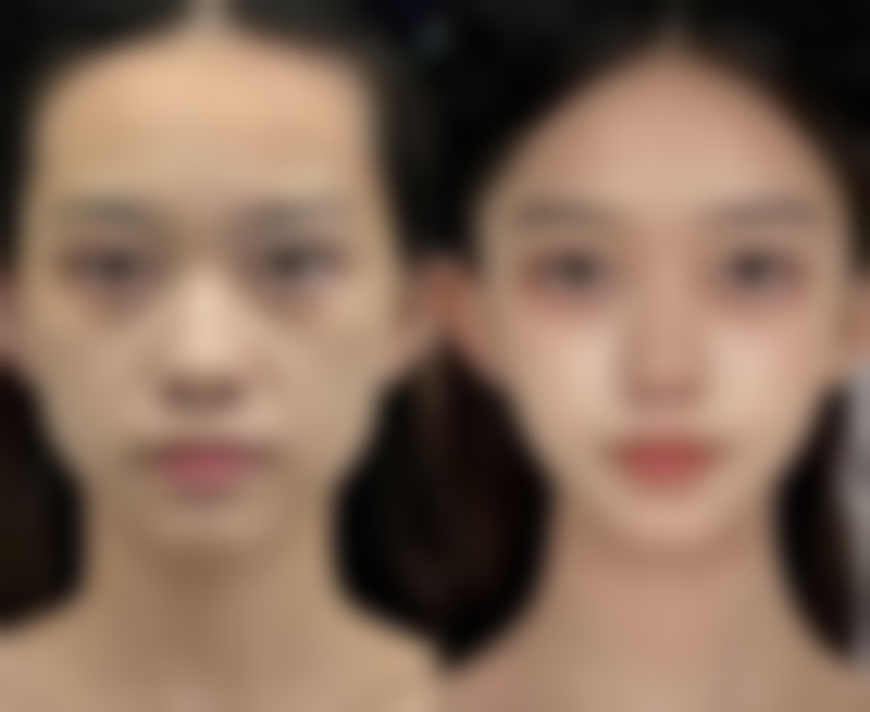 五、汨罗贝美整形医院收费价格表