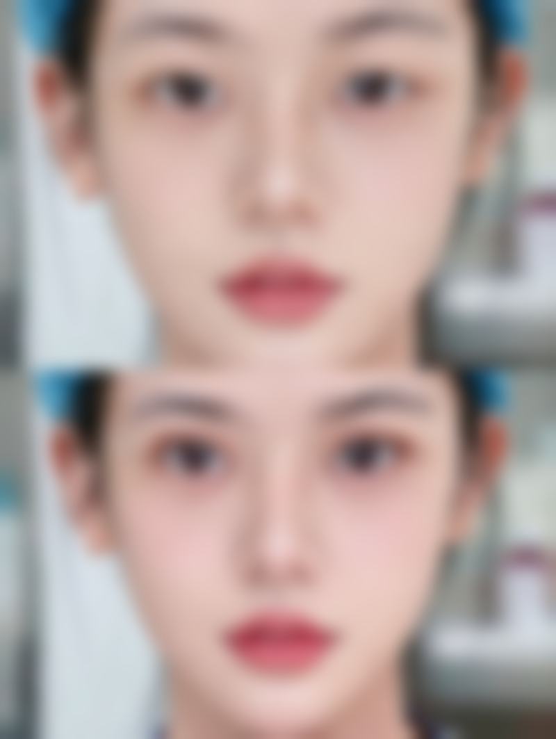 六、南平时光整形医院收费价格表