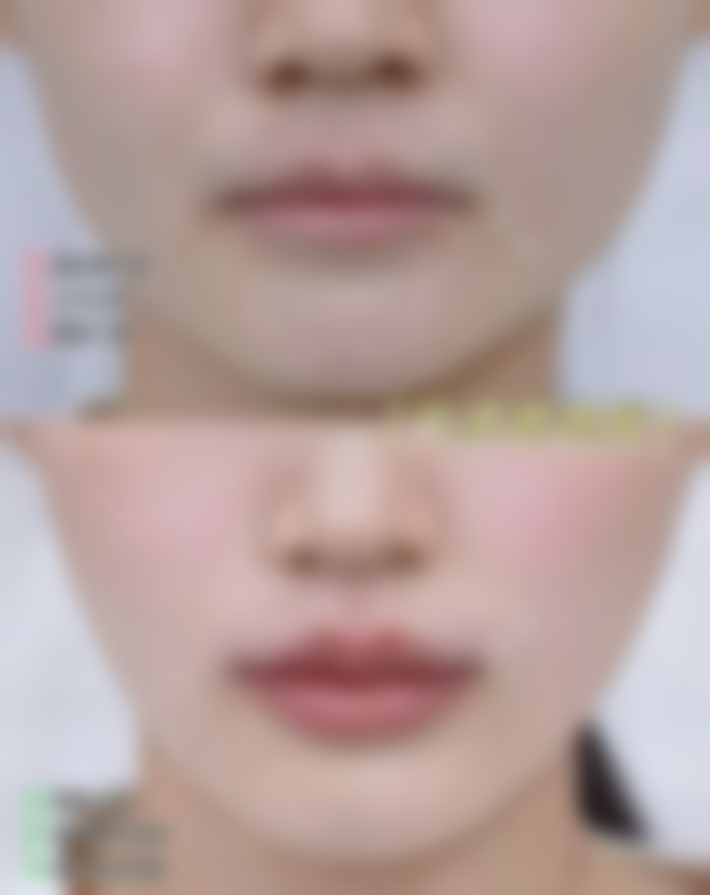 宋骁军 医生技术优势