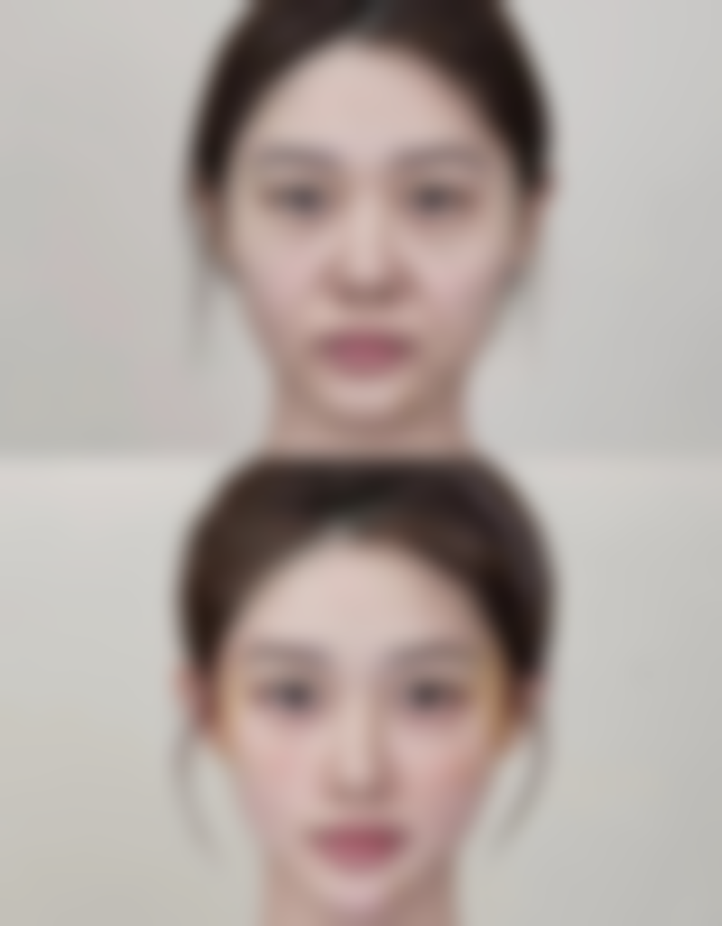 六、杭州康森整形医院口碑怎么样？