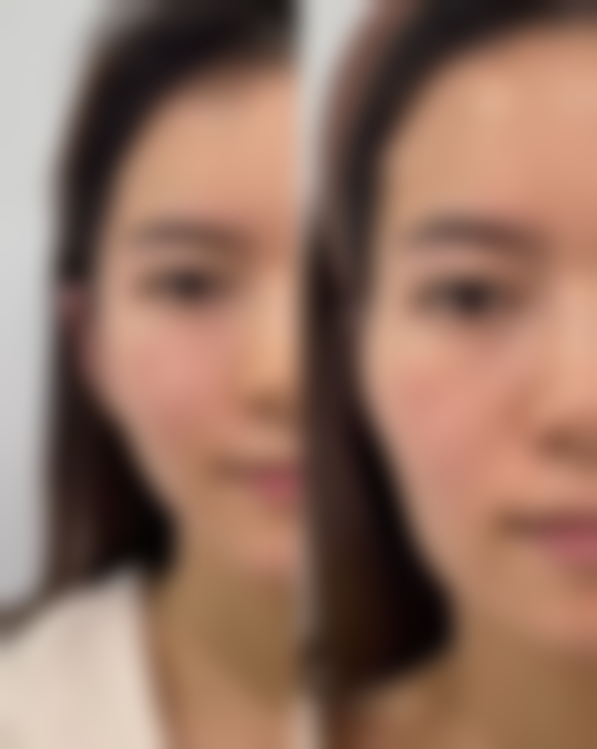 四、邯郸李婷整形美容诊所特色项目及技术优势