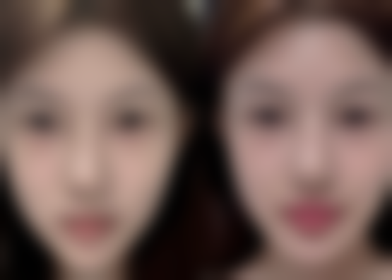 欧小勇医生擅长项目