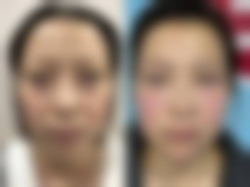 五、珠海薇淇迹医疗美容诊所收费价格表