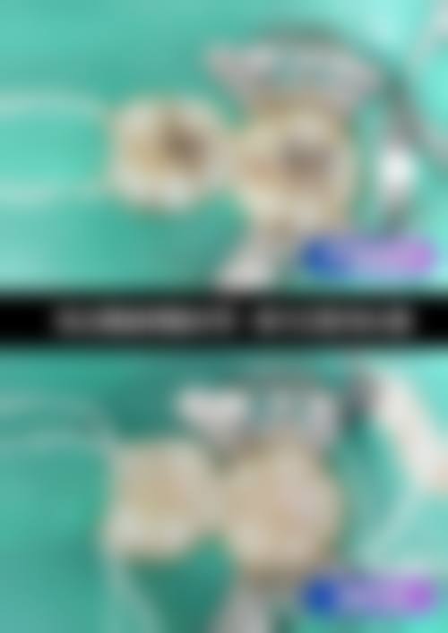 {龙港牙齿矫正哪家医院好？推荐牙贝恩等机构，资深医生、透明收费6999元起