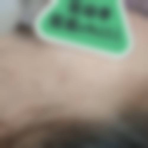 五、邯郸张小熊医疗美容诊所收费价格表