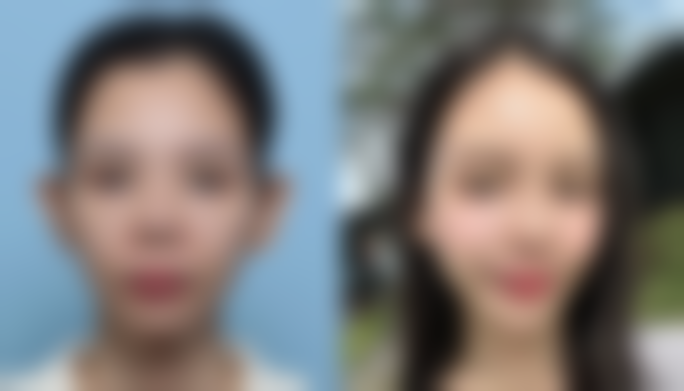 三、珠海薇淇迹医疗美容诊所特色项目及技术优势