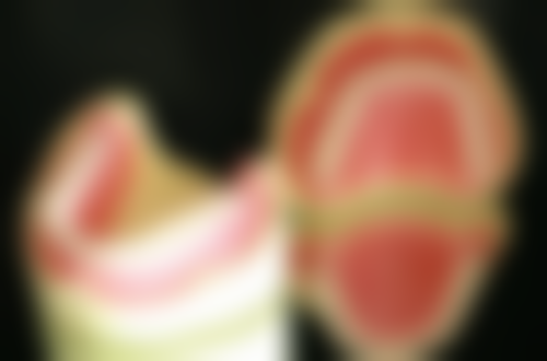 哪些情况该谨慎或推迟补牙呢？