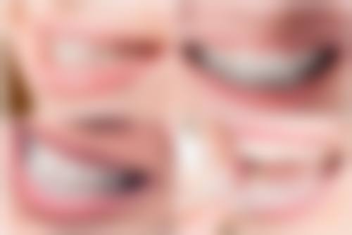 价格大对比：韩国与德国种植牙的成本差异