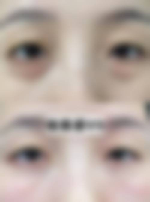 六、襄阳一起美整形医院口碑怎么样？