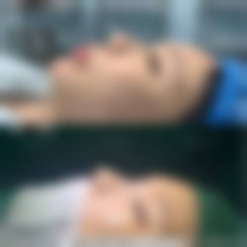 五、武警四川总队医院烧伤整形科收费价格表