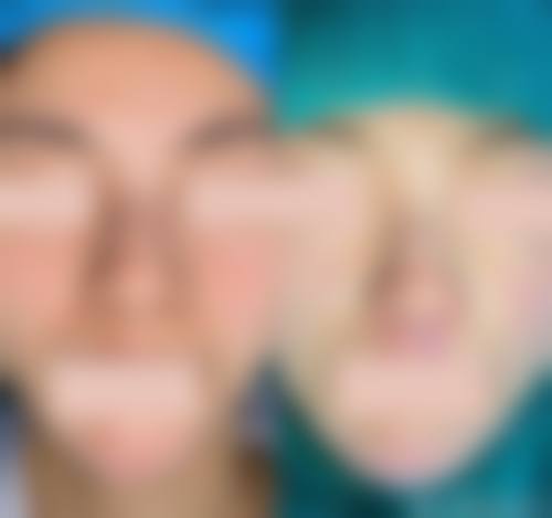 五、深圳王进胜医疗美容诊所谢慧慧医生简介