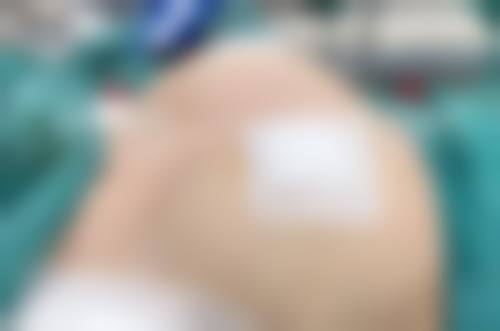 二、郑州市第一人民医院整形美容科是正规医院吗？