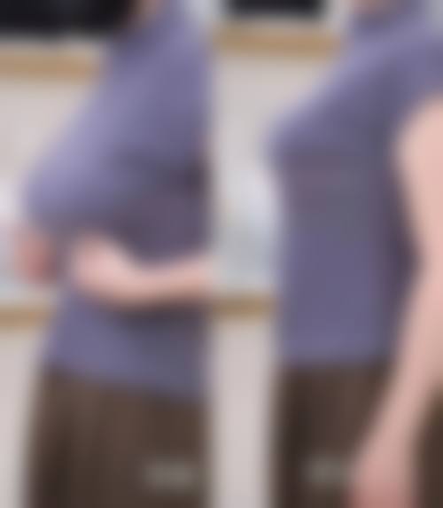 六、温州东华医院整形外科收费价格表