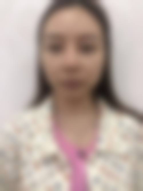 四、武警四川总队医院烧伤整形科特色项目及技术优势