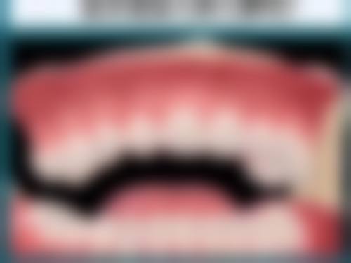 济南义齿价格情况